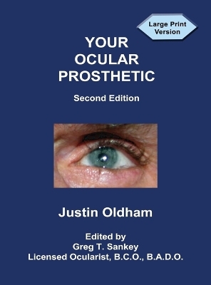 Your Ocular Prosthetic - Justin Oldham