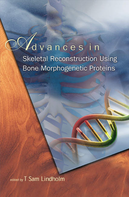 ADV IN SKELETAL RECONSTRUCTION USING.... - 