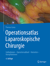 Operationsatlas Laparoskopische Chirurgie - Carus, Thomas