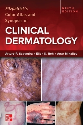 Fitzpatrick's Color Atlas and Synopsis of Clinical Dermatology, Ninth Edition - Arturo Saavedra, Ellen Roh, Anar Mikailov