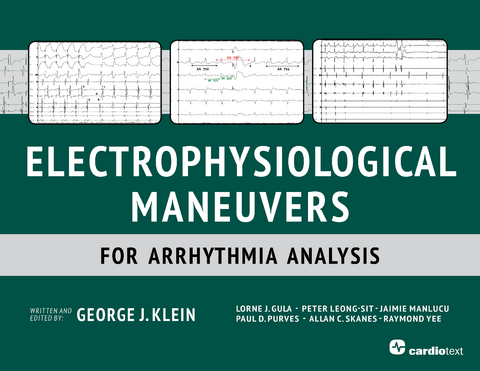 Electrophysiological Maneuvers for Arrhythmia Analysis - 