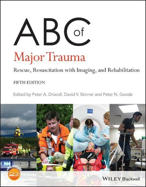 ABC of Major Trauma - 