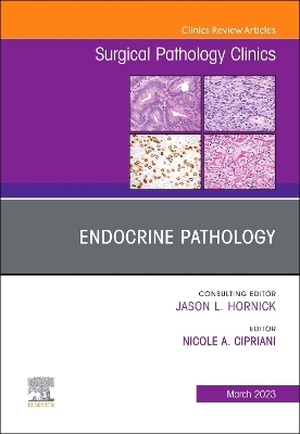 Endocrine Pathology, An Issue of Surgical Pathology Clinics - 