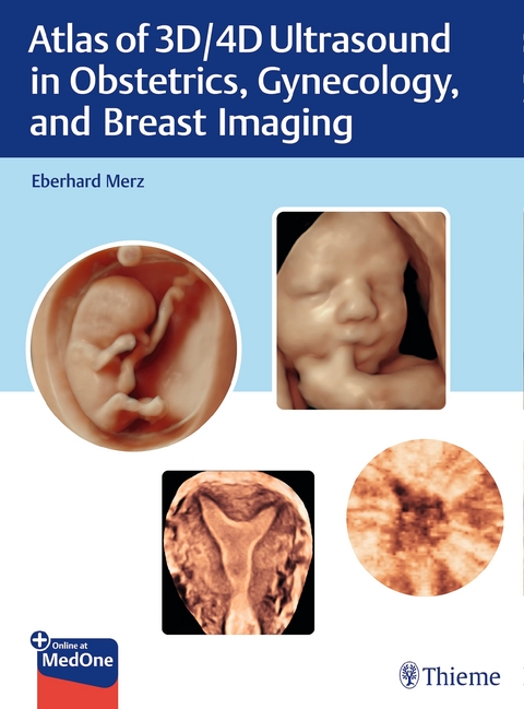 Atlas of 3D/4D Ultrasound in Obstetrics, Gynecology, and Breast Imaging - Eberhard Merz
