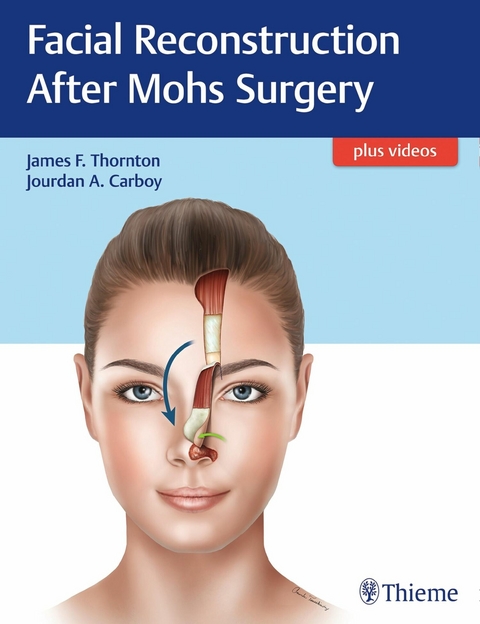 Facial Reconstruction After Mohs Surgery - 