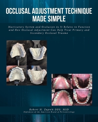 Occlusal Adjustment Technique Made Simple - Robert M Zupnik Msd