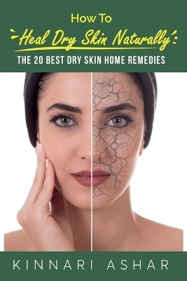 How to Heal Dry Skin Naturally - Kinnari Ashar