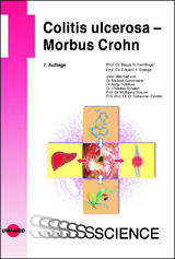 Colitis ulcerosa - Morbus Crohn - Herrlinger, Klaus R.; Stange, Eduard F.