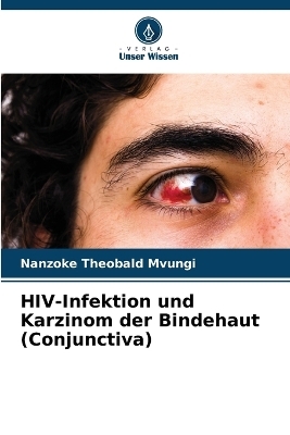 HIV-Infektion und Karzinom der Bindehaut (Conjunctiva) - Nanzoke Theobald Mvungi