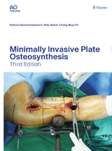 Minimally Invasive Plate Osteosynthesis - 