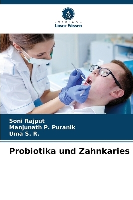 Probiotika und Zahnkaries - Soni Rajput, Manjunath P Puranik, Uma S R