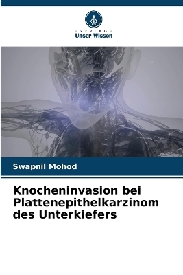 Knocheninvasion bei Plattenepithelkarzinom des Unterkiefers - Swapnil Mohod