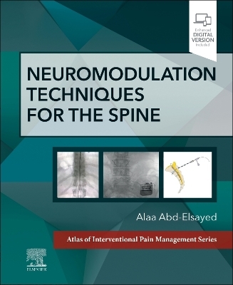 Neuromodulation Techniques for the Spine - Alaa Abd-Elsayed