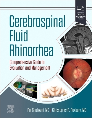 Cerebrospinal Fluid Rhinorrhea - 