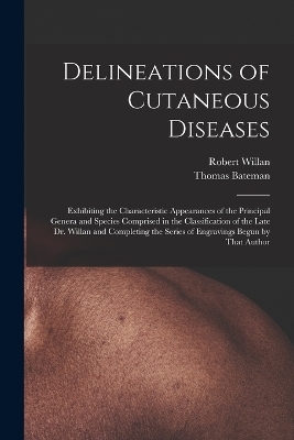 Delineations of Cutaneous Diseases - Robert Willan, Thomas Bateman