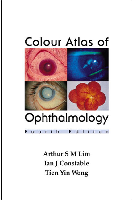 COLOUR ATLAS OPHTHALM (4TH ED) - Arthur Siew Ming Lim,  Constable;  ;  ;  Ian J