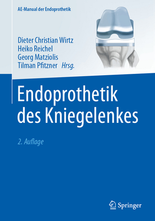 Endoprothetik des Kniegelenkes - Dieter Christian Wirtz; Heiko Reichel; Georg Matziolis …