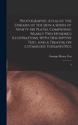 Photographic Atlas of the Diseases of the Skin a Series of Ninety-six Plates, Comprising Nearly two Hundred Illustrations, With Descriptive Text, and a Treatise on Cutaneous Therapeutics - George Henry Fox