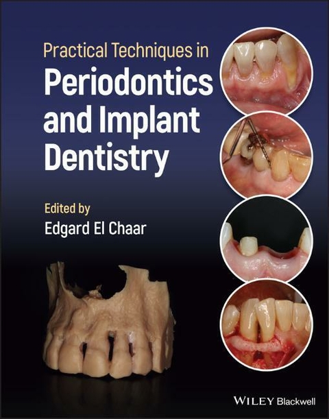 Practical Techniques in Periodontics and Implant Dentistry - Edgard El Chaar