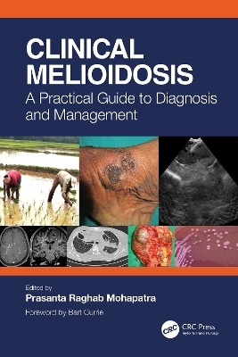 Clinical Melioidosis - 
