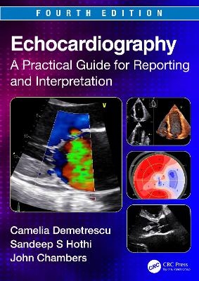 Echocardiography - Camelia Demetrescu, Sandeep S. Hothi, John Chambers