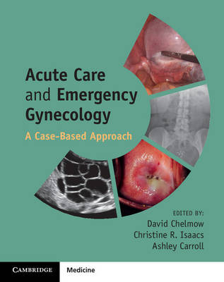 Acute Care and Emergency Gynecology - 