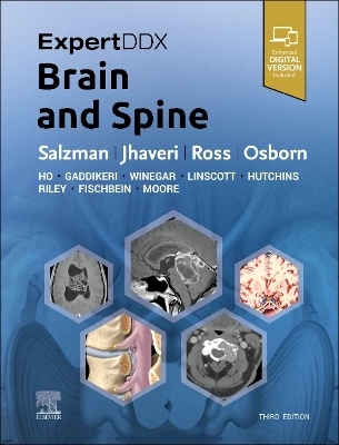 ExpertDDx: Brain and Spine - Karen L. Salzman, Miral D. Jhaveri, Jeffrey S. Ross