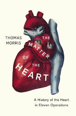 Matter of the Heart -  Thomas Morris