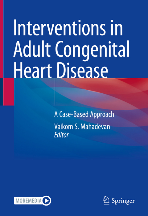 Interventions in Adult Congenital Heart Disease - 