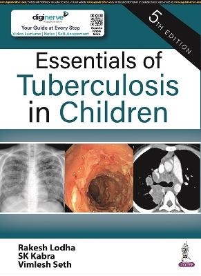 Essentials of Tuberculosis in Children - Rakesh Lodha, SK Kabra, Vimlesh Seth