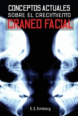 Conceptos Actuales Sobre El Crecimiento Cráneo-Facial - A M Rothman, E E Emborg