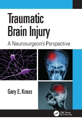 Traumatic Brain Injury: A Neurosurgeon's Perspective - Gary Kraus