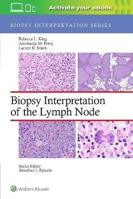 Biopsy Interpretation of the Lymph Node: Print + eBook with Multimedia - Rebecca Leigh King, Anamarija M. Perry, Lauren B. Smith