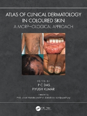 Atlas of Clinical Dermatology in Coloured Skin - 