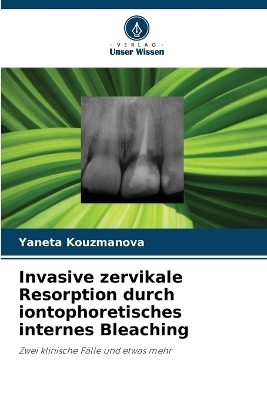 Invasive zervikale Resorption durch iontophoretisches internes Bleaching - Yaneta Kouzmanova