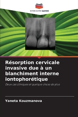 Résorption cervicale invasive due à un blanchiment interne iontophorétique - Yaneta Kouzmanova