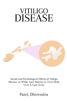 Social and Psychological Effects of Vitiligo Disease on White Spot Patients in Their Daily Lives A Case Study - Dhirendra Patel