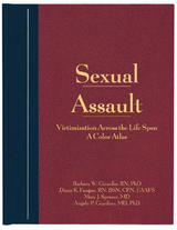Sexual Assault -  Diana K. Faugno,  Angelo P. Giardino,  Barbara W. Girardin,  Mary J. Spencer