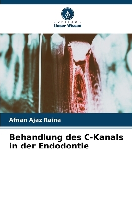 Behandlung des C-Kanals in der Endodontie - Afnan Ajaz Raina