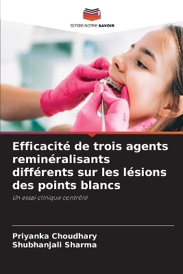 Efficacité de trois agents reminéralisants différents sur les lésions des points blancs - Priyanka Choudhary, Shubhanjali Sharma