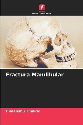 Fractura Mandibular - Himanshu Thukral