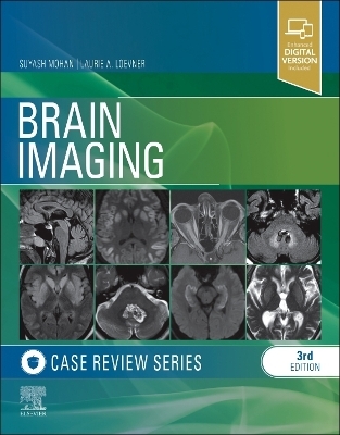 Brain Imaging: Case Review Series - Suyash Mohan, Laurie A. Loevner