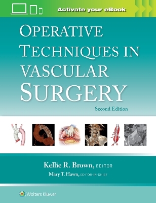 Operative Techniques in Vascular Surgery: Print + eBook with Multimedia - 