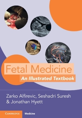 Fetal Medicine - 