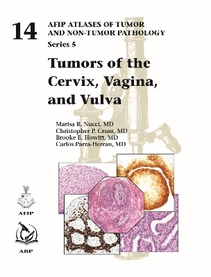 Tumors of the Cervix, Vagina, and Vulva - Marisa R. Nucci, Christopher P. Crum, Brooke E. Howitt, Carlos Parra-Herran