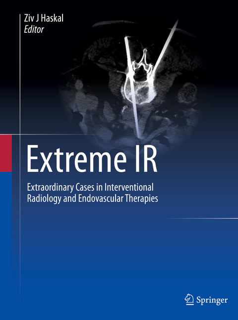 Extreme IR - 