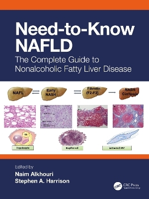 Need-to-Know NAFLD - 