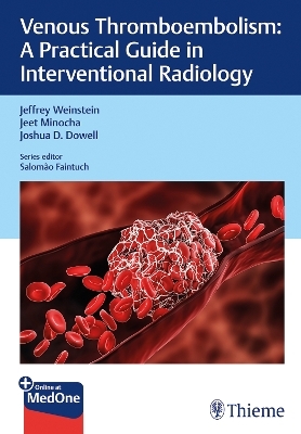 Venous Thromboembolism - Jeffrey Weinstein, Jeet Minocha, Joshua Dowell