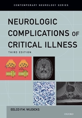 Neurologic Complications of Critical Illness - MD Eelco F.M. Wijdicks  Ph.D  FACP