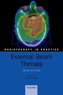 External Beam Therapy - Peter Hoskin